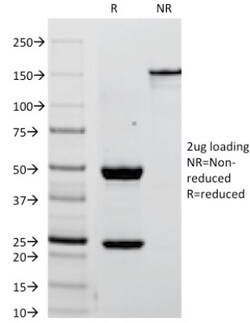 Alkaline Phosphatase/ALPP Antibody (ALPP/238), Novus Biologicals 0.2mg;